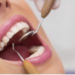 Секреты стойкого и здорового улыбки: эффективные методы лечения зубов